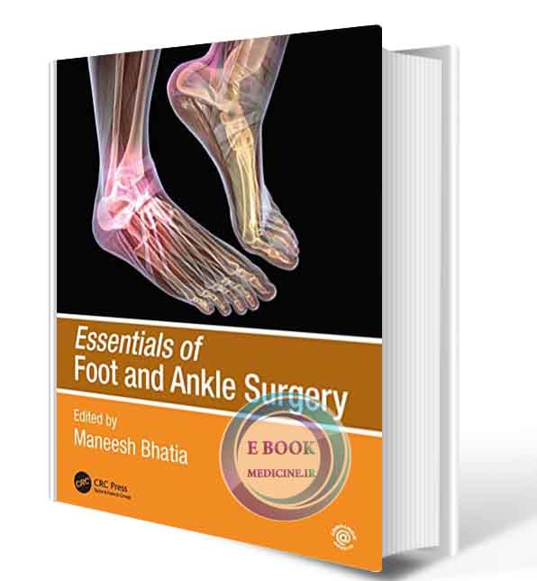 دانلود کتاب Essentials of Foot and Ankle Surgery 1st  2021 (ORIGINAL PDF)